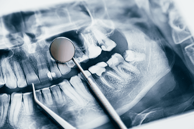 Mobile Dental Clinic